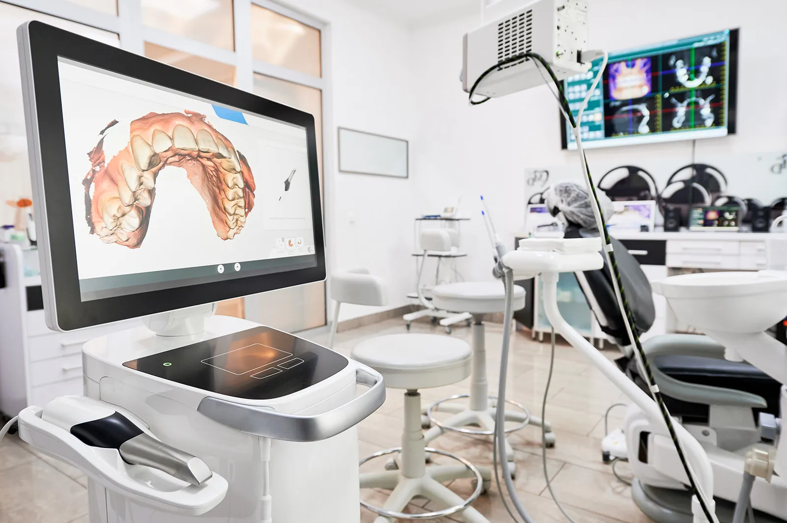 Digital scanner showing a 3D model of teeth in a dental operatory